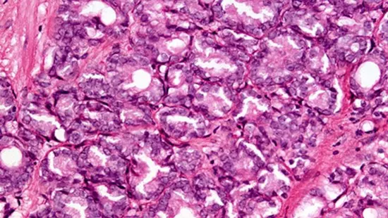 Darzsmreggel a rkos sejtek ellen