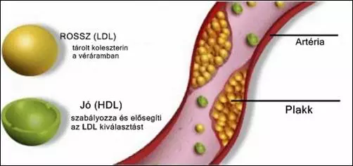 J� �s rossz koleszterin